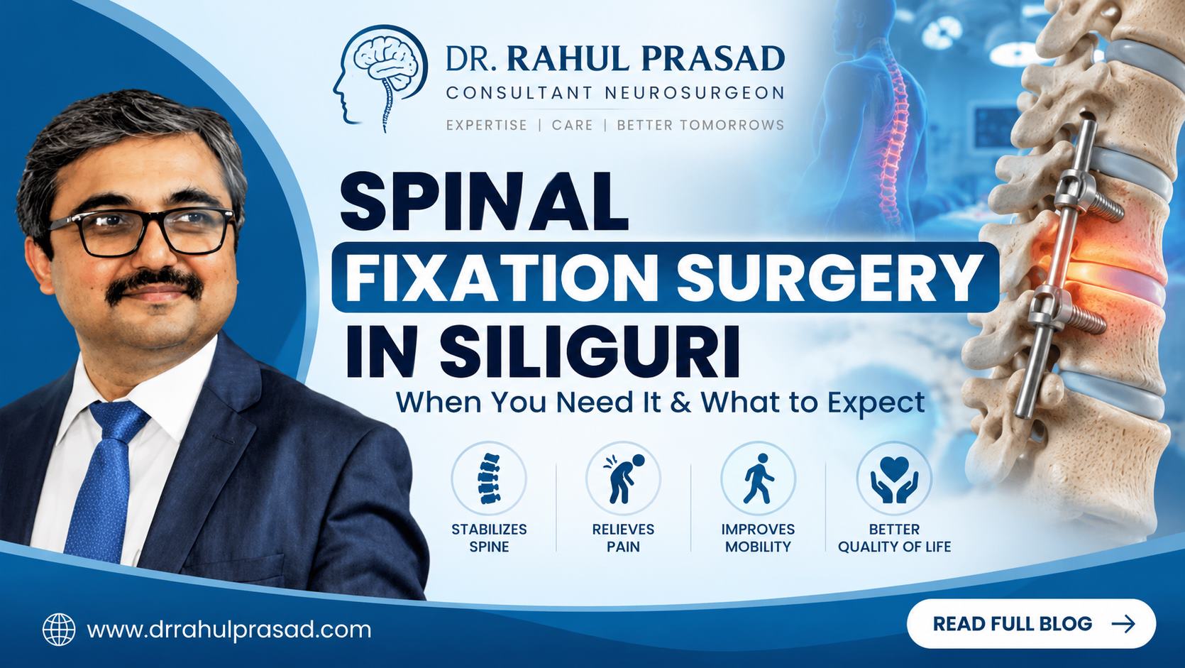 Spinal Fixation Surgery in Siliguri - Dr. Rahul Prasad