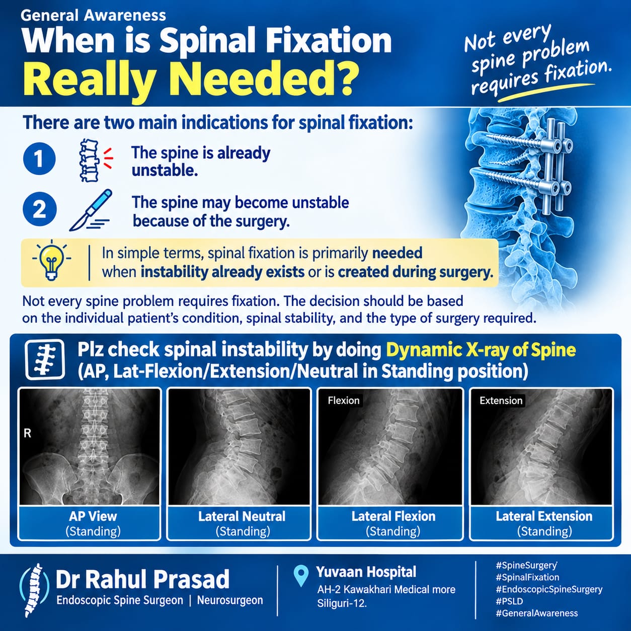 Spinal Fixation Surgery in Siliguri