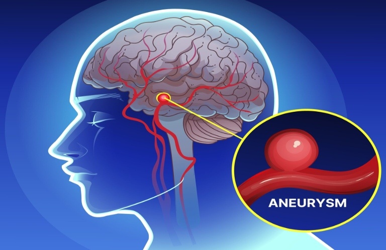 Neurosurgeon doctor in siliguri